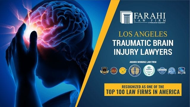 Los Angeles Brain injury Lawyers