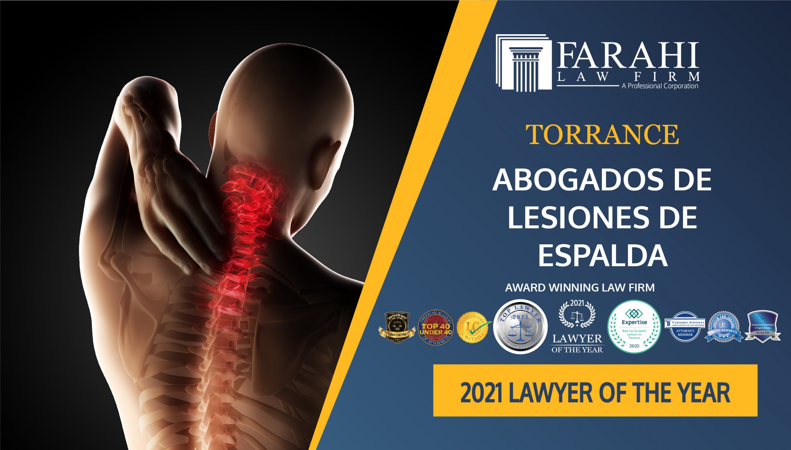 Spanish Back Injury Lawyers in Torrance