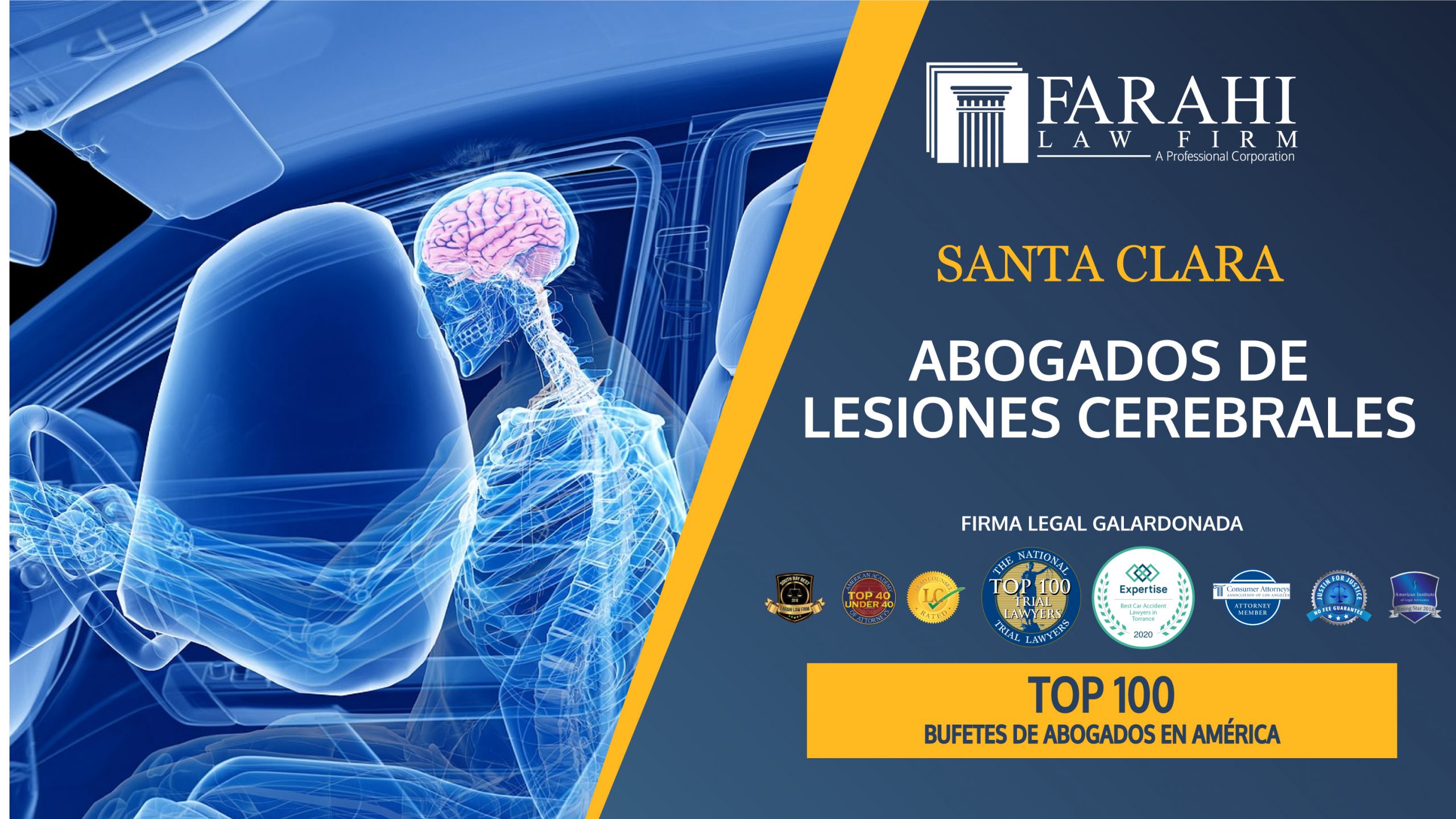 Spanish Brain Injury Lawyers in Santa Clara