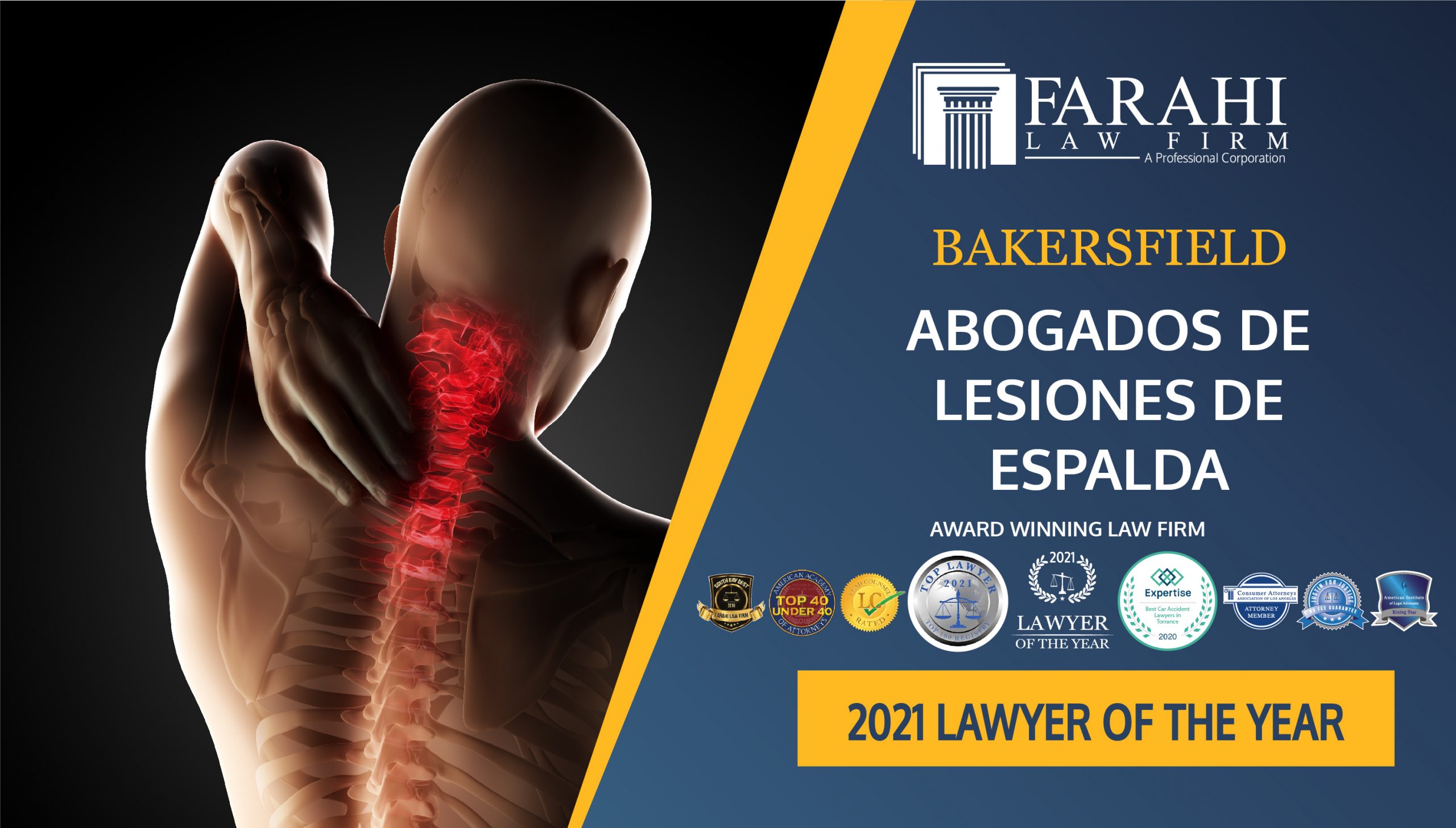 Spanish Back Injury Lawyers in Bakersfield