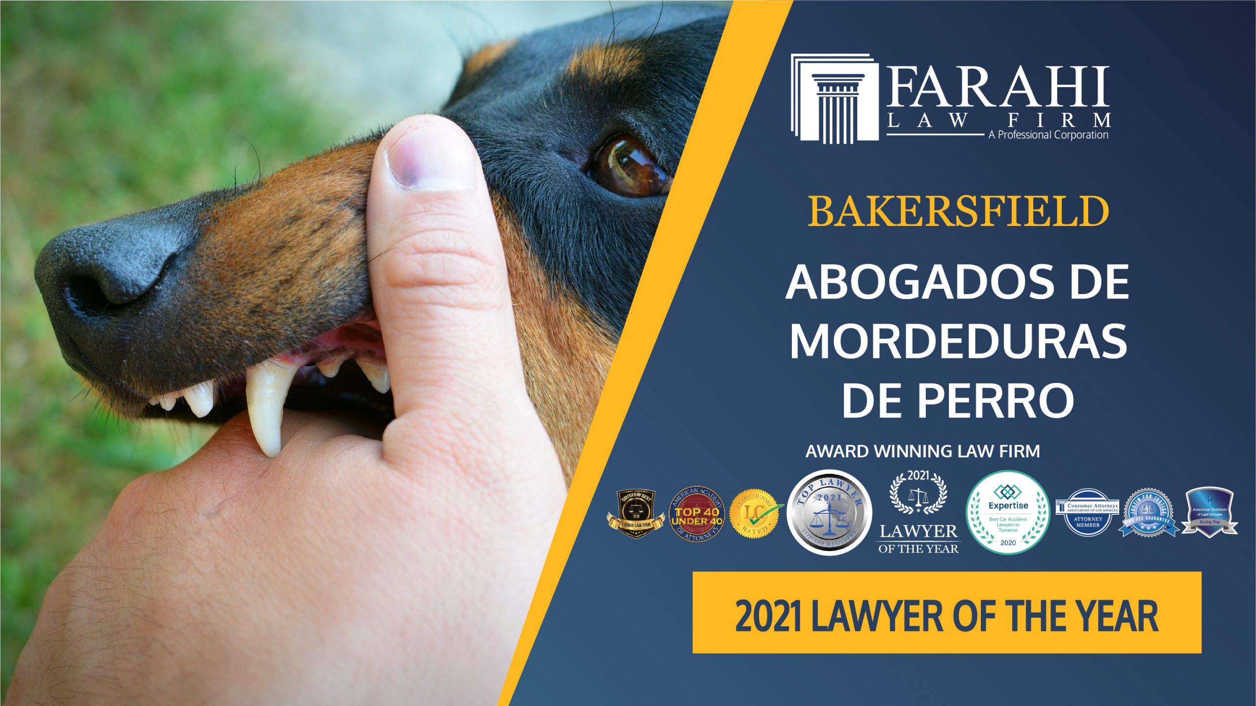 Spanish Dog Bite Lawyers in Bakersfield