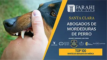 Santa Clara Abogados de Mordeduras de Perros miniatura